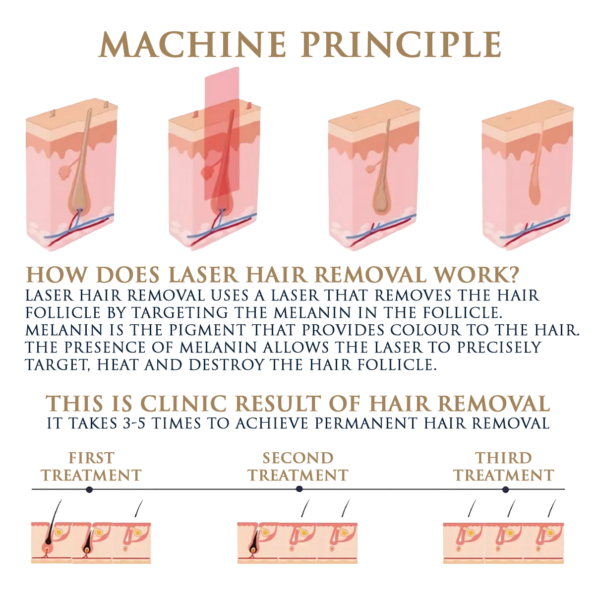 Skin Monarch Quantum Pro Dioden- und Pikosekundenlaser