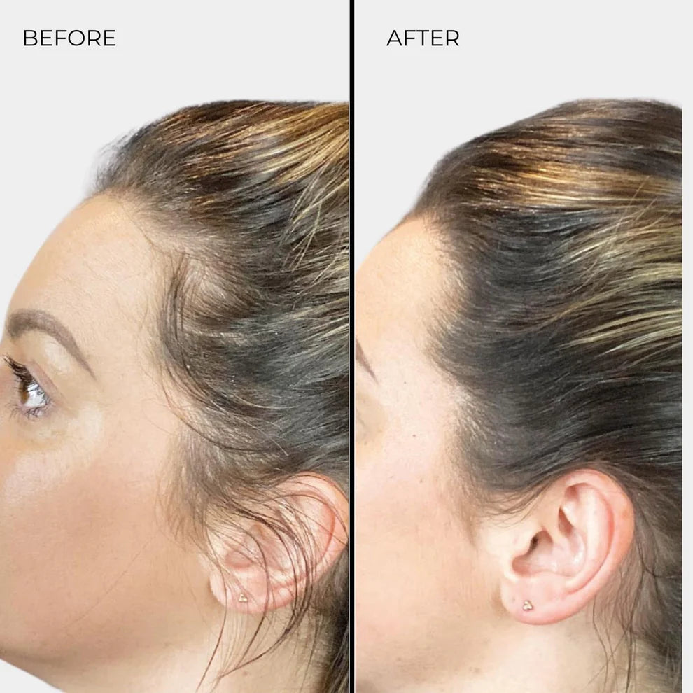 Nanogen Haarverdichtungsfasern Dunkelblond